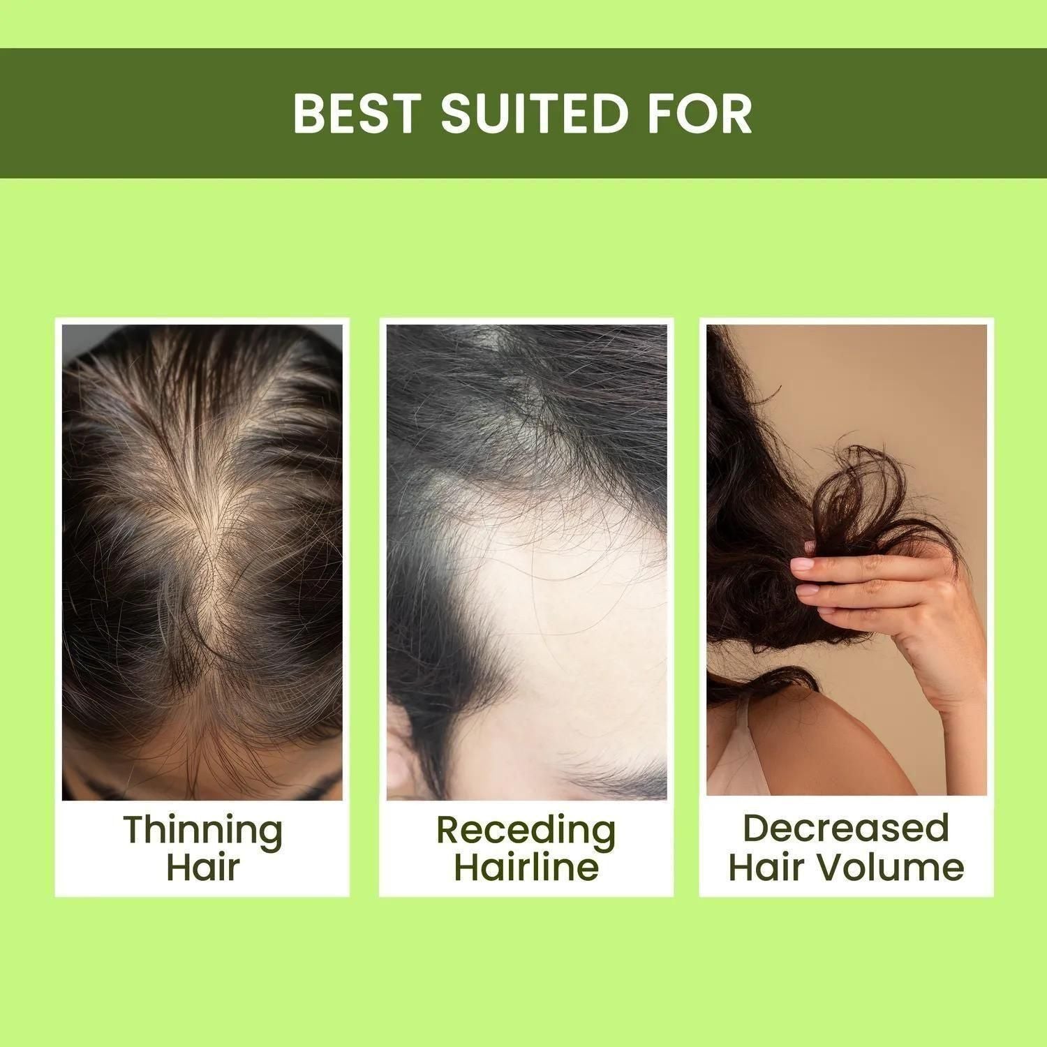 Rosemary Water, Hair Spray For Regrowth Buy 2 Get 1 Free